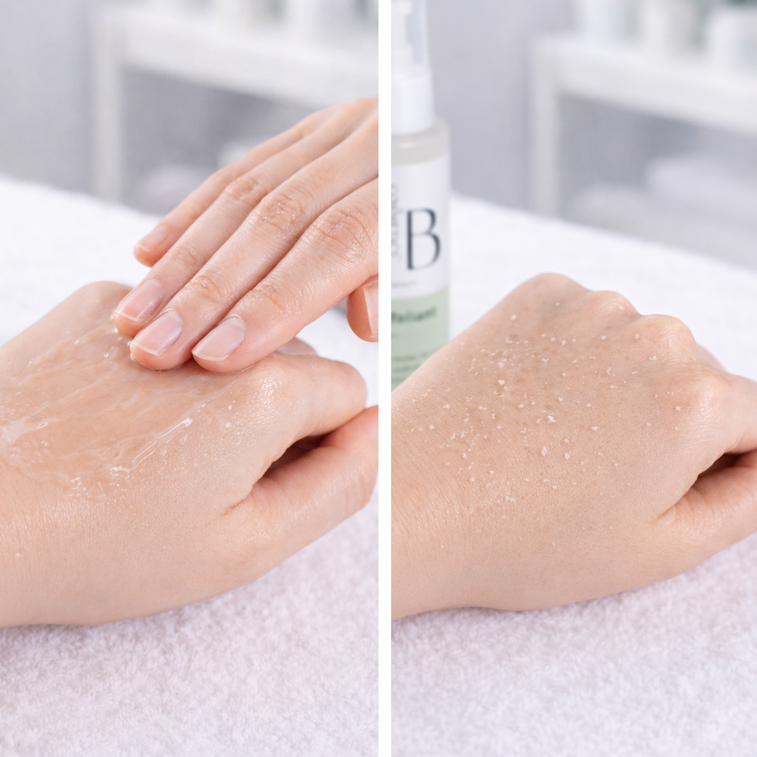 Gel exfoliant